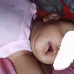 Pemkab beserta DPRD Madina menggalang donasi untuk pengobatan anak mengidap kanker mata yang dirawat di RS M Jamil Padang. 