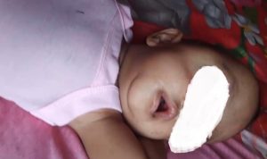 Pemkab beserta DPRD Madina menggalang donasi untuk pengobatan anak mengidap kanker mata yang dirawat di RS M Jamil Padang. 