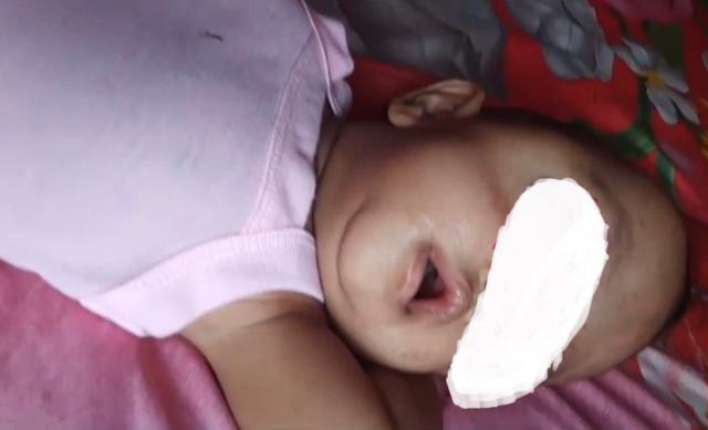 Pemkab beserta DPRD Madina menggalang donasi untuk pengobatan anak mengidap kanker mata yang dirawat di RS M Jamil Padang. 